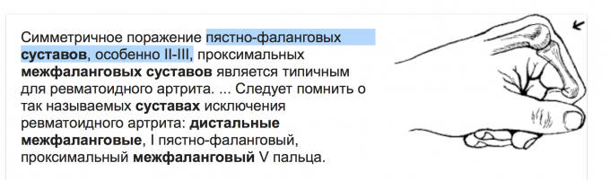 Мкб 10 растяжение связок голеностопного сустава код