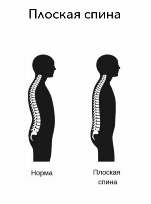 Картинки плоская спина